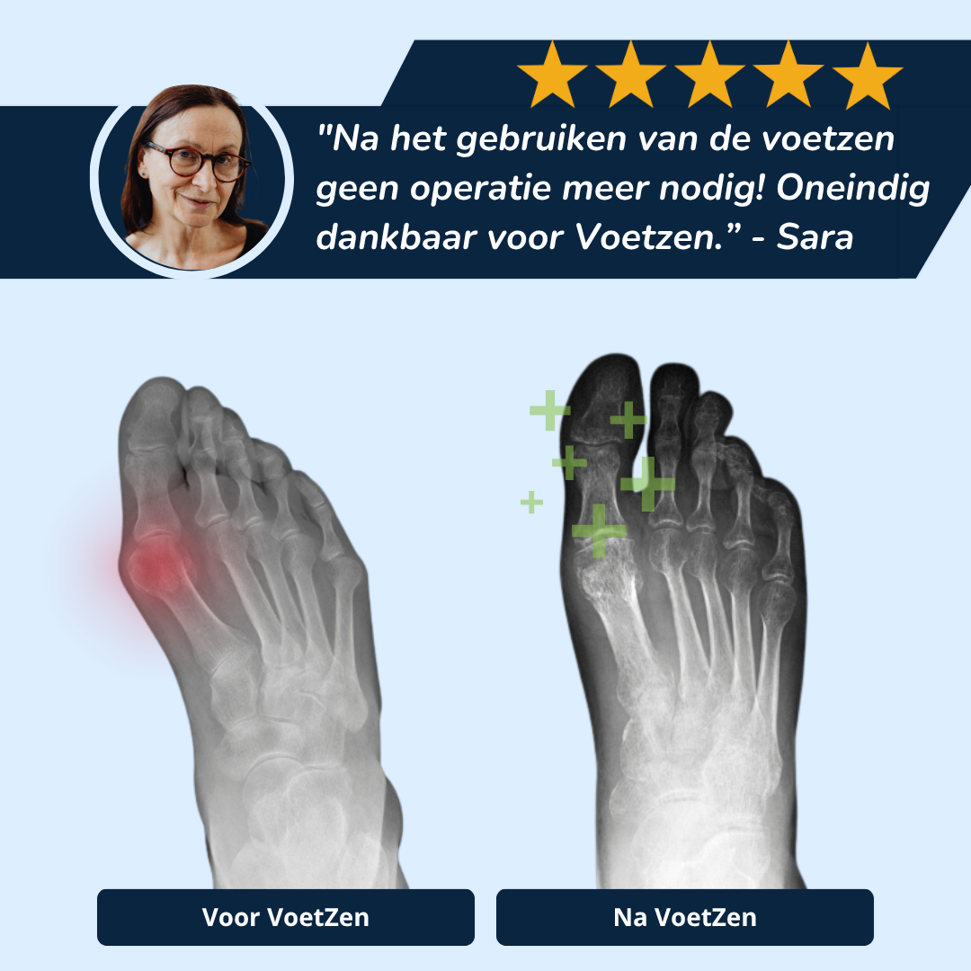 Zachte Gel Teensleeves voor Natuurlijk Comfort